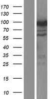 CACNB2 Protein (Over-Expression Lysate Myc-DDK (Flag))
