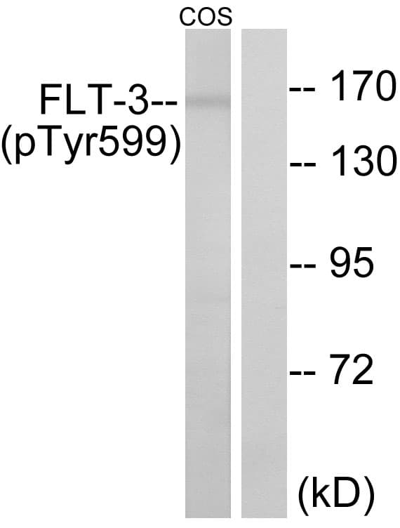 CD135 / FLT3 Antibody (phospho-Tyr599)