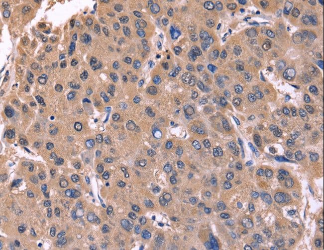 CSNK1D Antibody