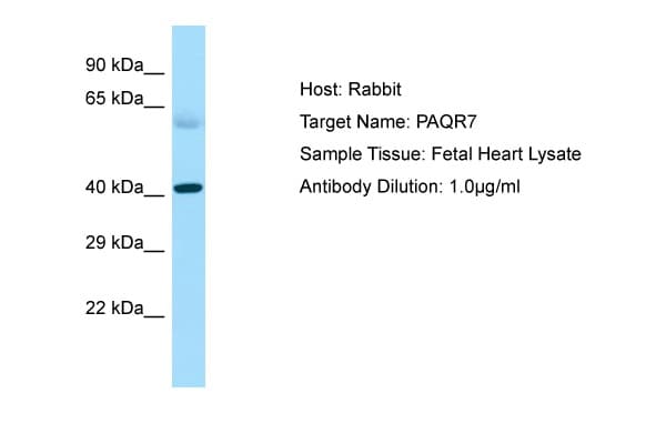 PAQR7 / mSR Antibody (C-Terminus)