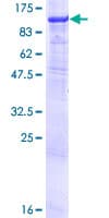 Human GYS1 / Glycogen Synthase Protein (Recombinant GST)