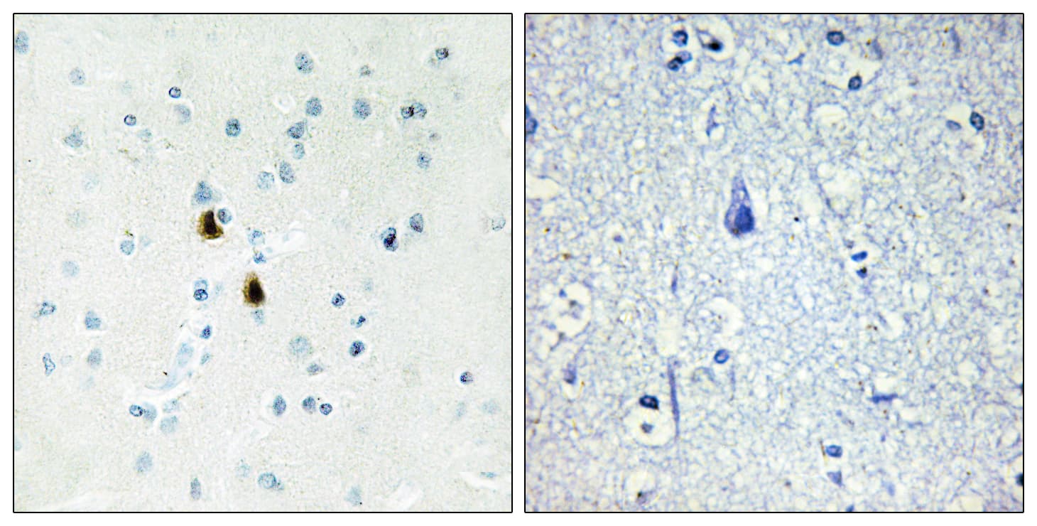 PKIA Antibody (aa10-59)