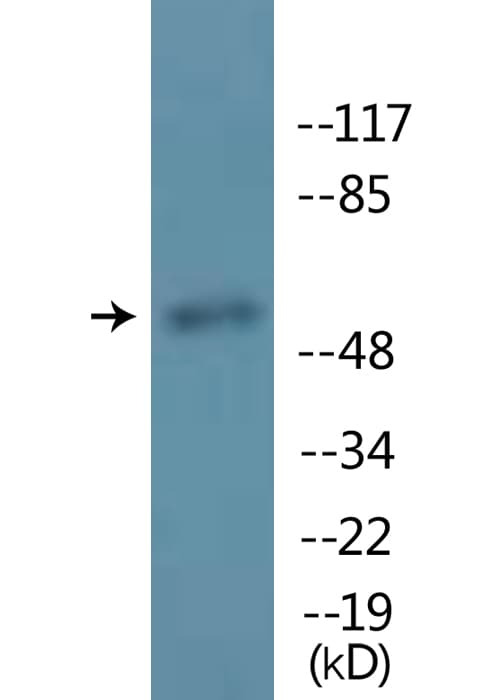 MITF Antibody (phospho-Ser180)