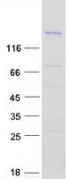 Human PSME4 / PA200 Protein (Recombinant Myc-DDK (Flag))