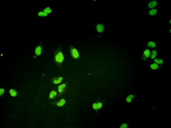 Monoclonal Mouse anti-Human TFB1 / GTF2H1 Antibody (clone 1F12-1B5, IF, WB)