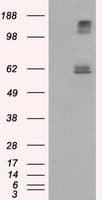 LIPG / Endothelial Lipase Antibody (clone OTI2A5)