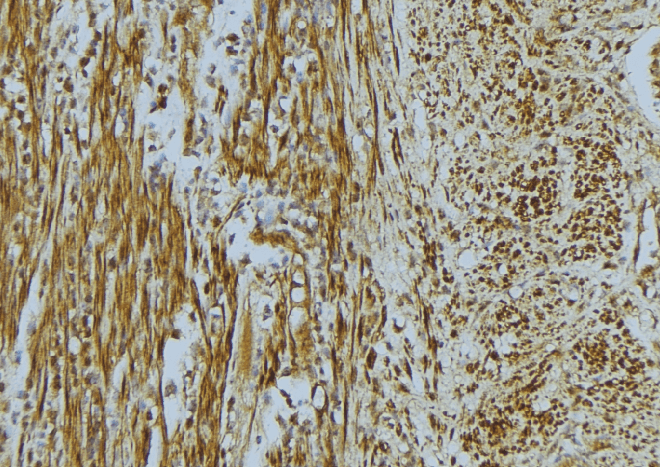 VCL / Vinculin Antibody