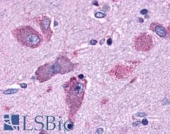 PathPlus™ GPR44 / CRTH2 Antibody (Extracellular Domain)