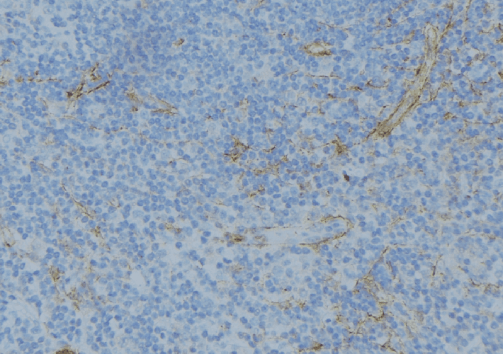 Polyclonal Rabbit anti-Human ABO Glycosyltransferase Antibody (IHC, IF, WB)