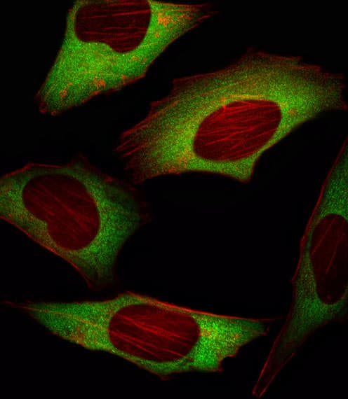 IHC-plus™ EIF4E Antibody