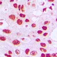TERT / Telomerase Antibody (phospho-Ser824)
