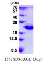 Human BCL2L10 / Diva Protein (Recombinant His)