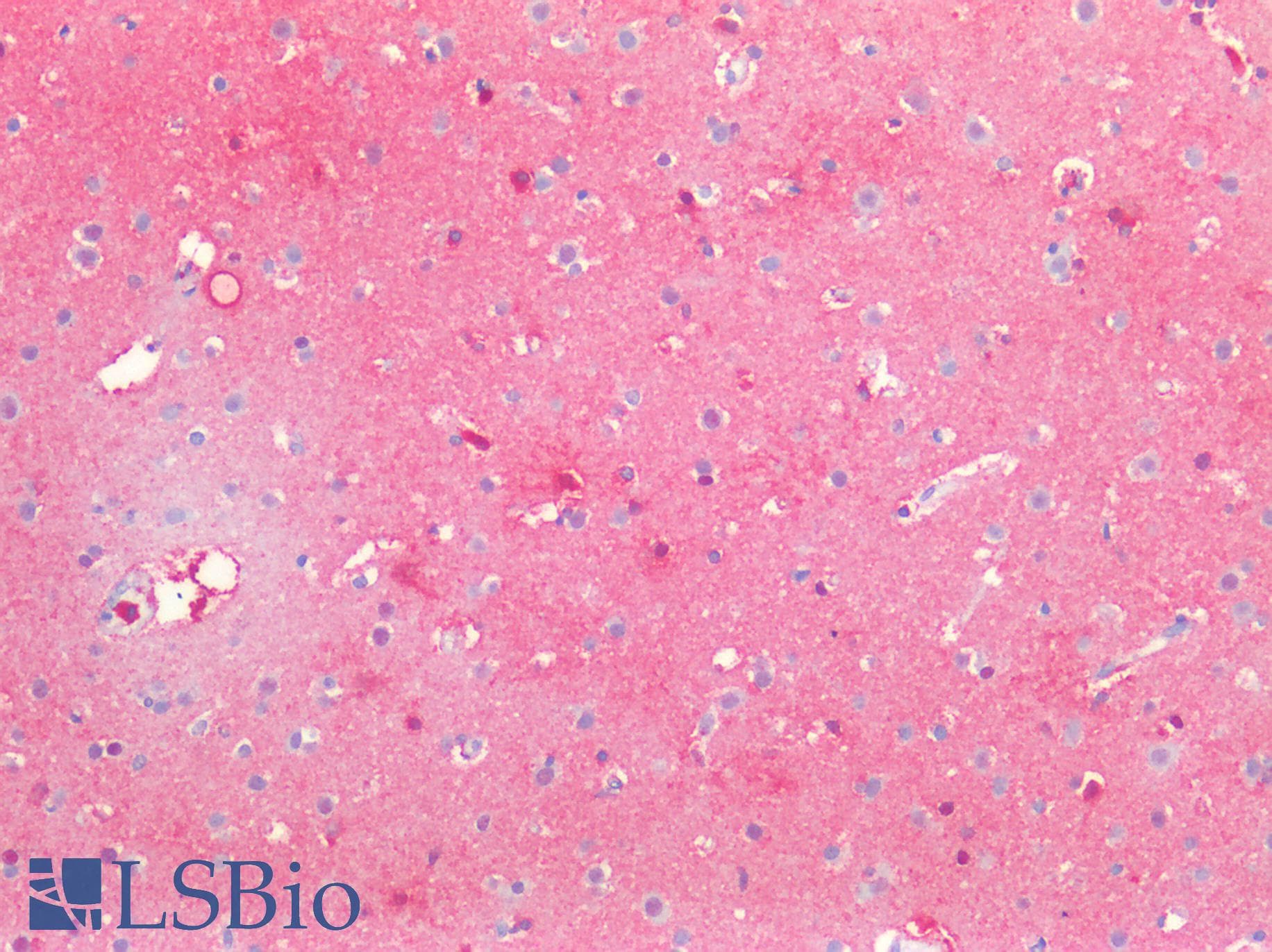 PathPlus™ SSEA-1 / Lewis x / CD15 Antibody (clone MC-480)