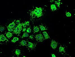 HSPA9 / Mortalin / GRP75 Antibody (clone OTI9F8)
