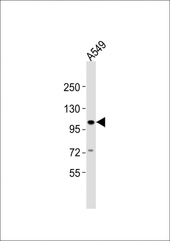 CHSY3 / CSS3 Antibody (aa751-785)