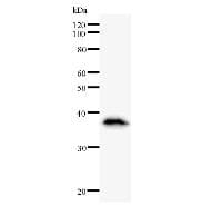MATR3 / Matrin 3 Antibody (clone 2539C3a)