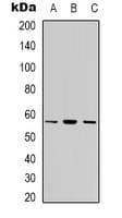 Polyclonal Rabbit anti-Human CYP7B1 Antibody (Internal, IHC, WB)