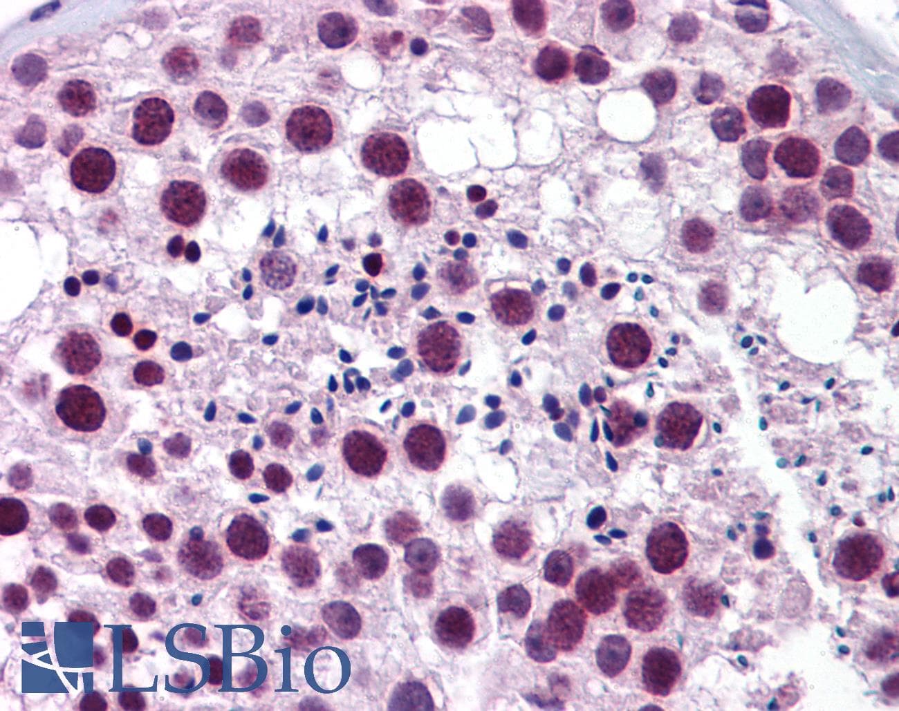 Polyclonal Rabbit anti-Human STAF50 / TRIM22 Antibody (aa74-123, IHC, WB)
