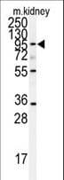 Polyclonal Rabbit anti-Human ADAM9 Antibody (aa35-64, WB)