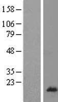 RPL26L1 Protein (Over-Expression Lysate Myc-DDK (Flag))