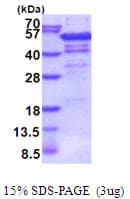 Human IP6K2 Protein (Recombinant His)