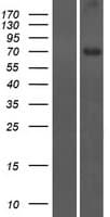 CCDC116 Protein (Over-Expression Lysate Myc-DDK (Flag))