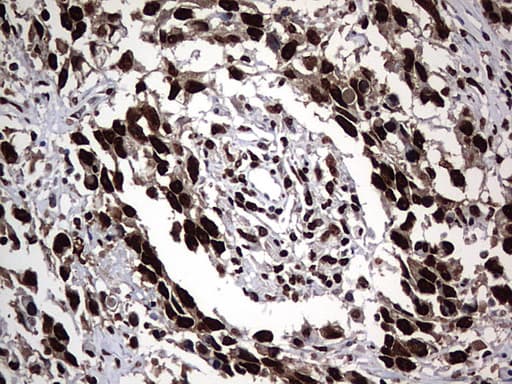 HNRPM / HNRNPM Antibody (aa1-261, clone OTI6H7)