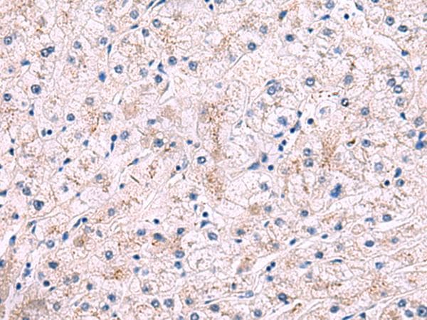 IP6K2 Antibody