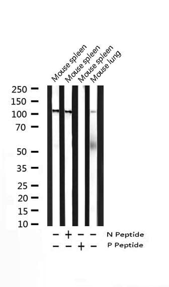 NFKB1 / NF-Kappa-B Antibody (phospho-Ser927)