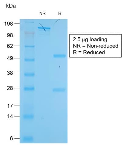 KRT19 / CK19 / Cytokeratin 19 Antibody (clone KRT19/1959R)