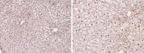 PPARA / PPAR Alpha Antibody (aa1-25)