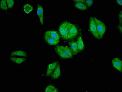 Polyclonal Rabbit anti-Human ARHGAP18 Antibody (IHC, WB)