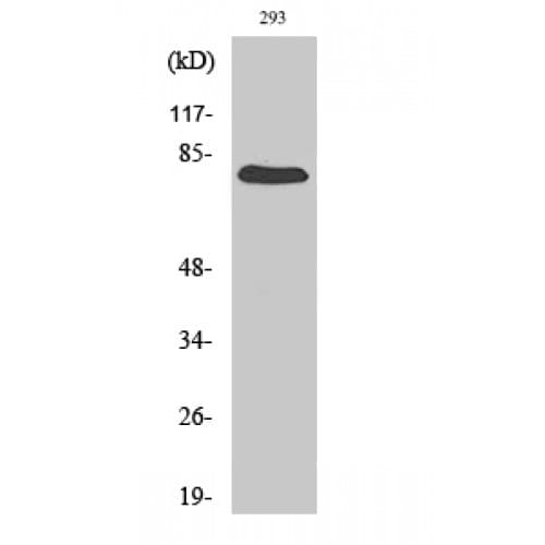 Polyclonal Rabbit anti-Human GAS6 Antibody (260-340 aa, Internal, IHC, WB)