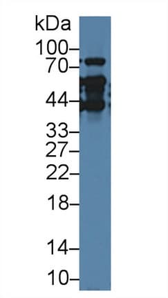 TMPO / TP / Thymopoietin Antibody (aa1-243, APC)