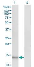 VEGFA / VEGF Antibody (clone 3F7)