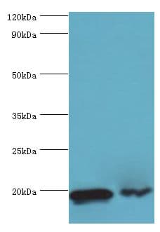 PTRH2 / BIT1 Antibody (aa40-179)