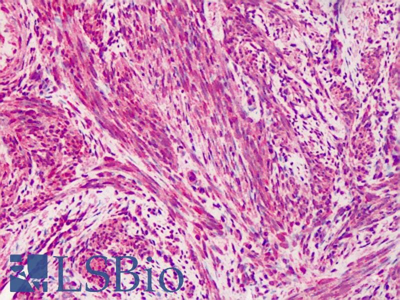 IHC-plus™ VCL / Vinculin Antibody (Azide-free)