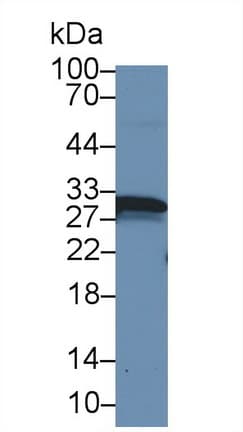 CA1 / Carbonic Anhydrase I Antibody (aa2-261, APC)