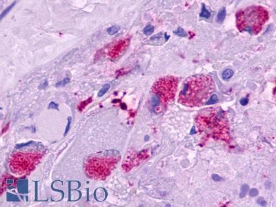 PathPlus™ Polyclonal Rabbit anti-Human MLNR/GPR38/Motilin Receptor Antibody (Cytoplasmic Domain, IHC)