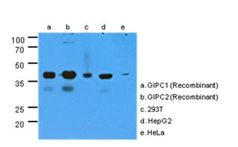 IHC-plus™ Monoclonal Mouse anti-Human GIPC1 / GIPC Antibody (clone AT1G10, IHC, WB)
