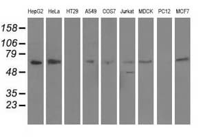Alpha-Fetoprotein Antibody (clone OTI2A9)