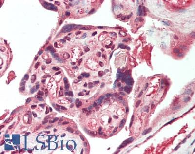 IHC-plus™ HPSE / Heparanase Antibody