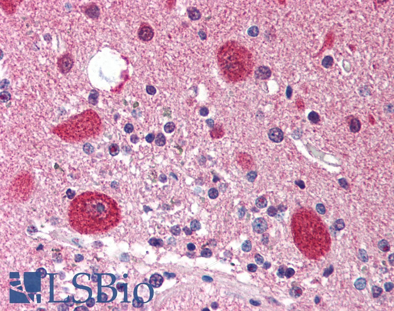IHC-plus™ Polyclonal Rabbit anti-Human STK11 / LKB1 Antibody (IHC, WB)