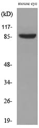 HRS / HGS Antibody