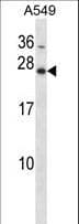 IHC-plus™ HOXB7 Antibody (aa94-122)