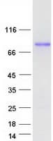 Human ARHGAP22 / RhoGAP2 Protein (Recombinant Myc-DDK (Flag))