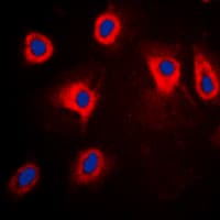 MAP3K8 / TPL2 Antibody (phospho-Thr290)