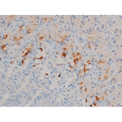 Polyclonal Rabbit anti-Human BCL2 / Bcl-2 Antibody (phospho-Ser70, IHC, IF, WB)