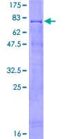 Human RING1 Protein (Recombinant GST)