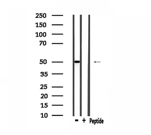 Polyclonal Rabbit anti-Human ADCK3 / CABC1 Antibody (IF, WB)